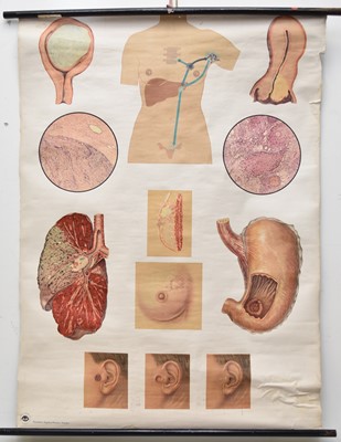 Lot 20 - A collection of various 20th century medical educational posters