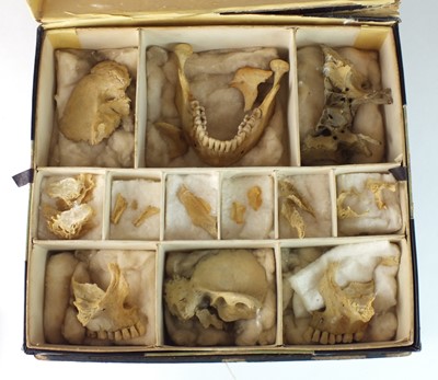 Lot 417 - A complete disarticulated human skull, circa 1920s/30s