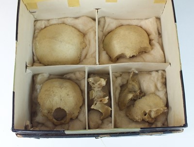 Lot 417 - A complete disarticulated human skull, circa 1920s/30s